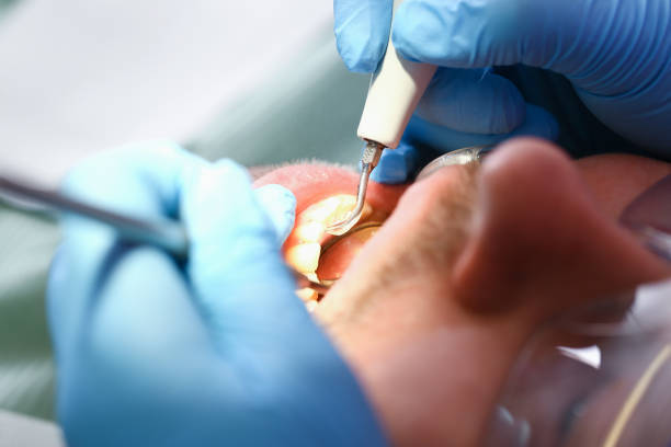 Best Chipped Tooth Repair Near Me  in Williamsburg, OH