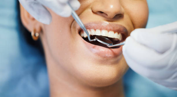 Best Teeth Whitening  in Williamsburg, OH